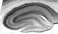 Adult rat hippocampus immunohistochemistry.