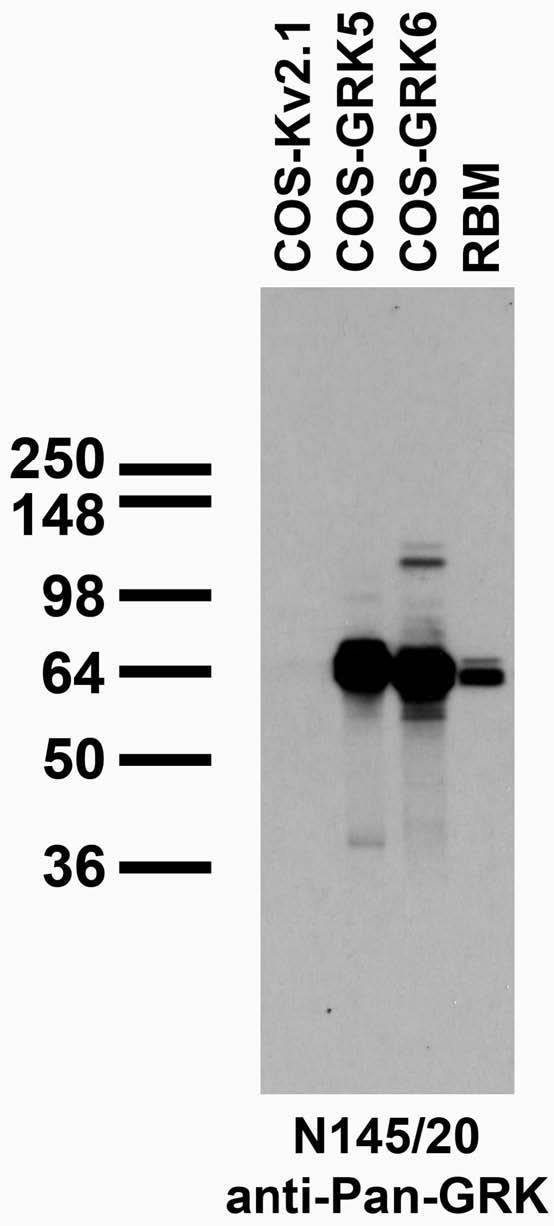 Immunoblot against adult rat brain membrane (RBM) and extracts of COS cells transiently transfected with untagged GRK5, GRK6 or Kv2.1 plasmid and probed with N145/20 TC supe.