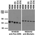 Immunoblot against crude membrane fractions from whole mouse (MBM) or rat (RBM) brain and from human hippocampus [HBM(H)], cerebral cortex [HBM(Cx)] or cerebellum [HBM(Cb)] and probed with N145/20 (left) or N52A/42 (right) TC supe.