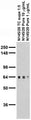 Adult rat brain membrane immunoblot.