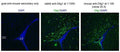 Immunofluorescence of postnatal day 17 mouse corpus callosum (CC) near lateral ventricle (LV). Data courtesy of Hui-Hsin Tsai and David Rowitch, UCSF.