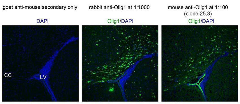 Immunofluorescence of postnatal day 17 mouse corpus callosum (CC) near lateral ventricle (LV). Data courtesy of Hui-Hsin Tsai and David Rowitch, UCSF.