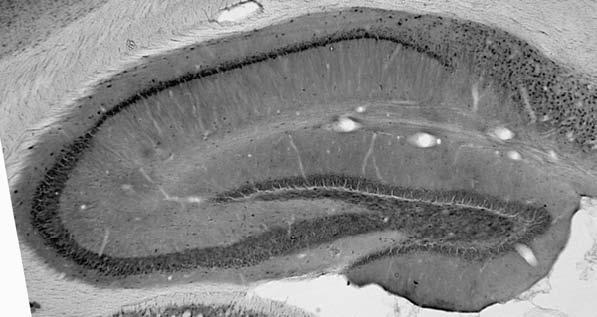 Adult rat hippocampus immunohistochemistry.