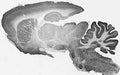 Adult rat brain immunohistochemistry.