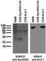 Adult rat brain membrane (RBM) and transfected cell immunoblot: extracts of RBM and COS cells transiently transfected with HA-tagged SynDIG3 or untagged Kv2.1 plasmid and probed with N160/21 (left) and K89/41 (right) TC supe.