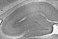 Adult rat hippocampus immunohistochemistry.