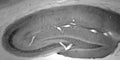 Adult rat hippocampus immunohistochemistry.