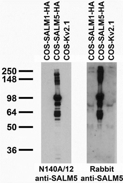 Transfected cell immunoblot: extracts of COS cells transiently transfected with HA- tagged SALM1 and SALM5 and untagged Kv2.1 plasmids and probed with N140A/12 TC supe (left) and rabbit anti-SALM5 (right).