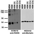 Immunoblot versus crude brain membranes from adult mouse (MBM), rat (RBM) and human hippocampus [HBM(H)], cerebral cortex [HBM(Cx)] and cerebellum [HBM(Cb)] probed with N196/16 (left) or N52A/42 (right) TC supe.