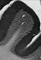 Immunohistochemistry of Purkinje cell bodies and dendrites in cerebellar cortex.