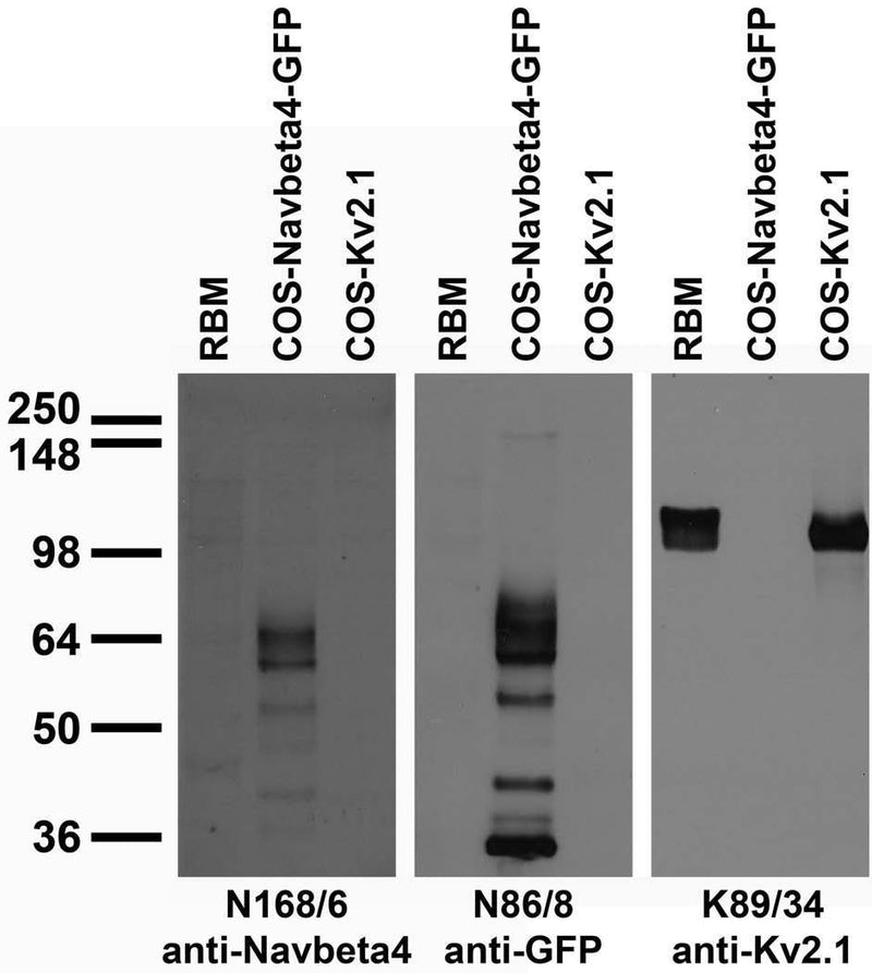 Adult rat brain membrane (RBM) and transfected cell immunoblot: extracts of RBM and COS cells transiently transfected with GFP-tagged Navbeta4 or untagged Kv2.1 plasmid and probed with N168/6 (left), N86/8 (middle) and K89/34 (right) TC supe.