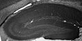 Adult rat hippocampus immunohistochemistry.