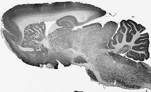 Adult rat brain immunohistochemistry.
