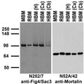 Immunoblot against crude membrane fractions from whole mouse (MBM) or rat (RBM) brain and from human hippocampus [HBM(H)], cerebral cortex [HBM(Cx)] or cerebellum [HBM(Cb)] and probed with N202/7 (left) or N52A/42 (right) TC supe.