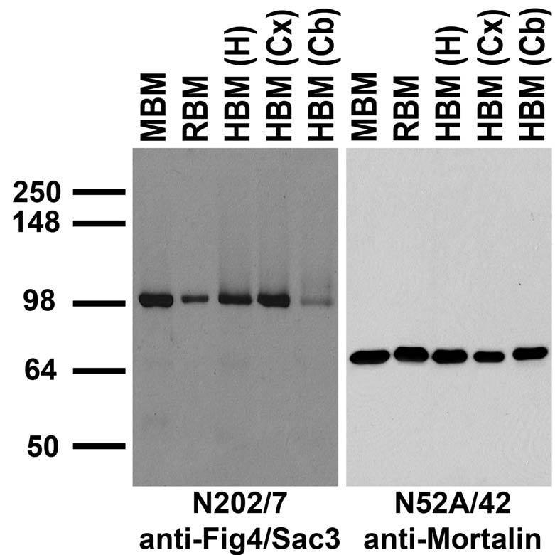 Immunoblot against crude membrane fractions from whole mouse (MBM) or rat (RBM) brain and from human hippocampus [HBM(H)], cerebral cortex [HBM(Cx)] or cerebellum [HBM(Cb)] and probed with N202/7 (left) or N52A/42 (right) TC supe.