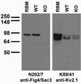 Immunoblot against adult rat brain membranes (RBM) and samples from wild-type (WT) and Fig4/Sac3 knockout (KO) mice probed with N202/7 (left) and K89/41 (right) TC supe. Mouse brain samples courtesy of Miriam Meisler (University of Michigan).