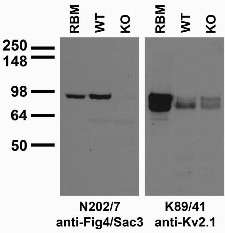 Immunoblot against adult rat brain membranes (RBM) and samples from wild-type (WT) and Fig4/Sac3 knockout (KO) mice probed with N202/7 (left) and K89/41 (right) TC supe. Mouse brain samples courtesy of Miriam Meisler (University of Michigan).