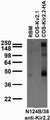 Adult rat brain membrane (RBM) and transfected cell immunoblot: extracts of RBM and COS cells transiently transfected with HA-tagged Kir2.2 or untagged Kv2.1 plasmids and probed with N124B/38 TC supe.