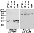 Immunoblot against membranes from livers of wild-type (WT) and VDAC1 knockout (KO) mice and brains of WT mice (MBM) and rat (RBM). Liver samples courtesy of Tatiana Sheiko and Bill Craigen (Baylor College of Medicine).