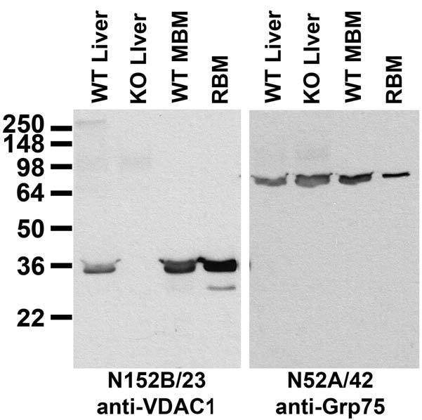 Immunoblot against membranes from livers of wild-type (WT) and VDAC1 knockout (KO) mice and brains of WT mice (MBM) and rat (RBM). Liver samples courtesy of Tatiana Sheiko and Bill Craigen (Baylor College of Medicine).