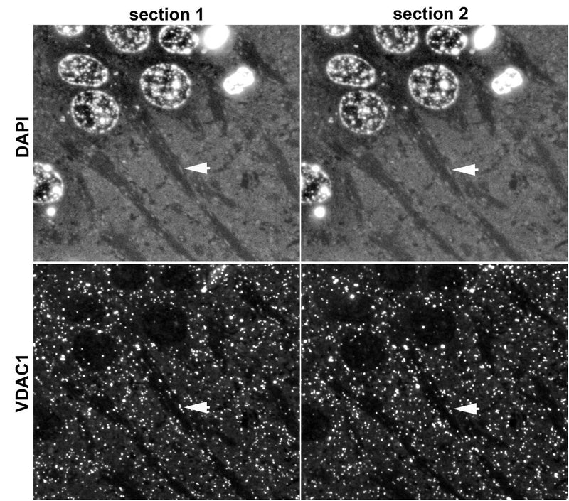 Array tomography immunofluorescence of 70 nm sections of LRWhite-embedded adult mouse hippocampus. Two consecutive sections labeled with N152B/23 (bottom) and DAPI (top), where low level autofluorescence reveals mitochondria appearing as brighter elongated structures within darker apical dendrites (arrows). Images courtesy of Kristina Micheva (Stanford).