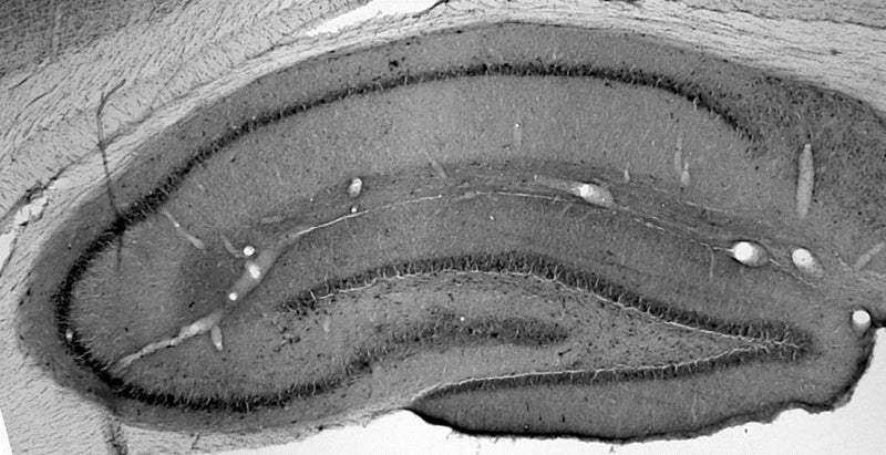 Adult rat hippocampus immunohistochemistry.