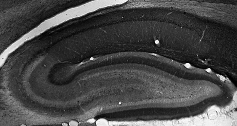 Adult rat hippocampus immunohistochemistry.