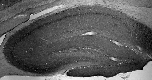 Adult rat hippocampus immunohistochemistry.