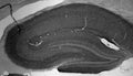 Adult rat hippocampus immunohistochemistry.