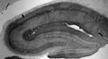 Adult rat hippocampus immunohistochemistry.