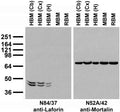 Immunoblot against crude membrane fractions from whole rat (RBM) or mouse (MBM) brain and from human hippocampus [HBM(H)], cerebral cortex [HBM(Cx)] or cerebellum [HBM(Cb)] probed with N84/37 (left) or N52A/42 (right) TC supe.