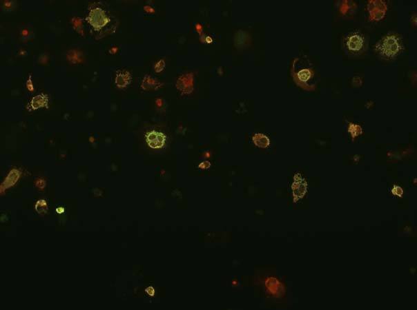 Transfected cell immunofluorescence: COS cells expressing Flag-tagged human Neureguline-HBD. Red = rabbit anti-Flag, Green = N120A/9.