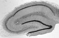 Adult rat hippocampus immunohistochemistry (with antigen retrieval via pepsin pretreatment.