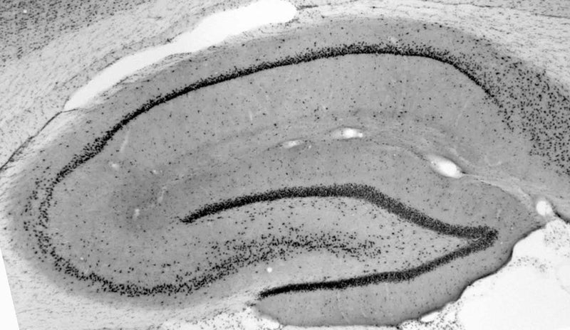 Adult rat hippocampus immunohistochemistry.