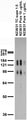 Adult rat brain membrane (RBM) immunoblot.
