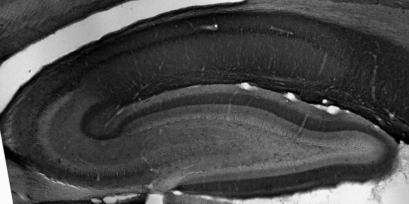 Adult rat hippocampus immunohistochemistry.