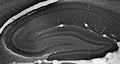 Adult rat hippocampus immunohistochemistry.