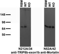 Immunoblot versus crude membranes from adult rat brain (RBM) and WT and TRIP8b KO mouse brains probed with N212A/34 (left) and N52A/42 (right) TC supe. Mouse samples courtesy of Dane Chetkovich (Northwestern University).
