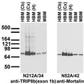 Immunoblot against crude membranes from whole rat (RBM) and mouse (MBM) brain and from human cerebellum (HBM(Cb)], cerebral cortex [HBM(Cx)] and hippocampus [HBM(H)] probed with N212A/34 (left) or N52A/42 (right) TC supe.