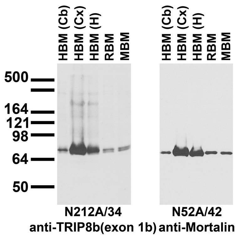 Immunoblot against crude membranes from whole rat (RBM) and mouse (MBM) brain and from human cerebellum (HBM(Cb)], cerebral cortex [HBM(Cx)] and hippocampus [HBM(H)] probed with N212A/34 (left) or N52A/42 (right) TC supe.