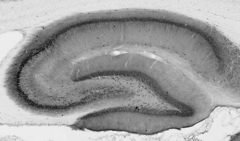 Adult rat hippocampus immunohistochemistry.
