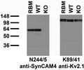Immunoblot versus adult rat brain membranes (RBM) and adult mouse brain membranes from wild-type (WT) and SynCAM4 knockout (KO) mice and probed with N244/5 (left) and K89/41 (right) TC supe. Samples courtesy of Matt Rasband, Baylor College of Medicine.