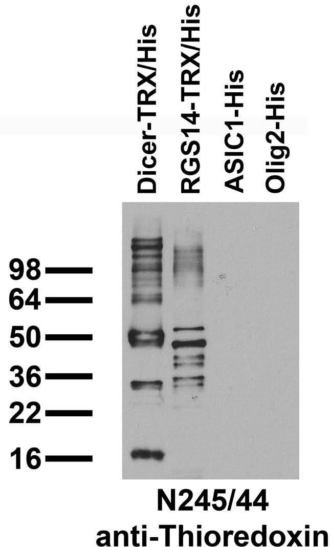 Immunoblot against bacterially expressed Thioredoxin (TRX) and/or 6xHistidine (His) tagged fusion proteins.