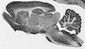 Adult rat brain immunohistochemistry.