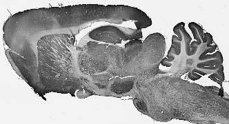 Adult rat brain immunohistochemistry.