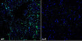 Immunofluorescence against SUR1 WT (left) and null mutant (right) mouse striatum and stained with N289/16 (green) and commercial antibody against Tyrosine Hydroxylase (blue). Images courtesy of Paul Witkovsky, Jyoti Patel and Margaret Rice, New York University Medical Center.