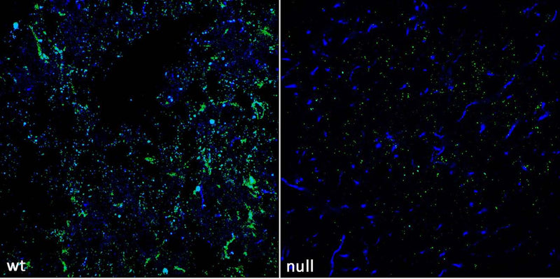 Immunofluorescence against SUR1 WT (left) and null mutant (right) mouse striatum and stained with N289/16 (green) and commercial antibody against Tyrosine Hydroxylase (blue). Images courtesy of Paul Witkovsky, Jyoti Patel and Margaret Rice, New York University Medical Center.