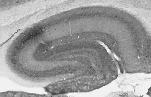 Adult rat hippocampus immunohistochemistry (with antigen retrieval via Na citrate pretreatment).