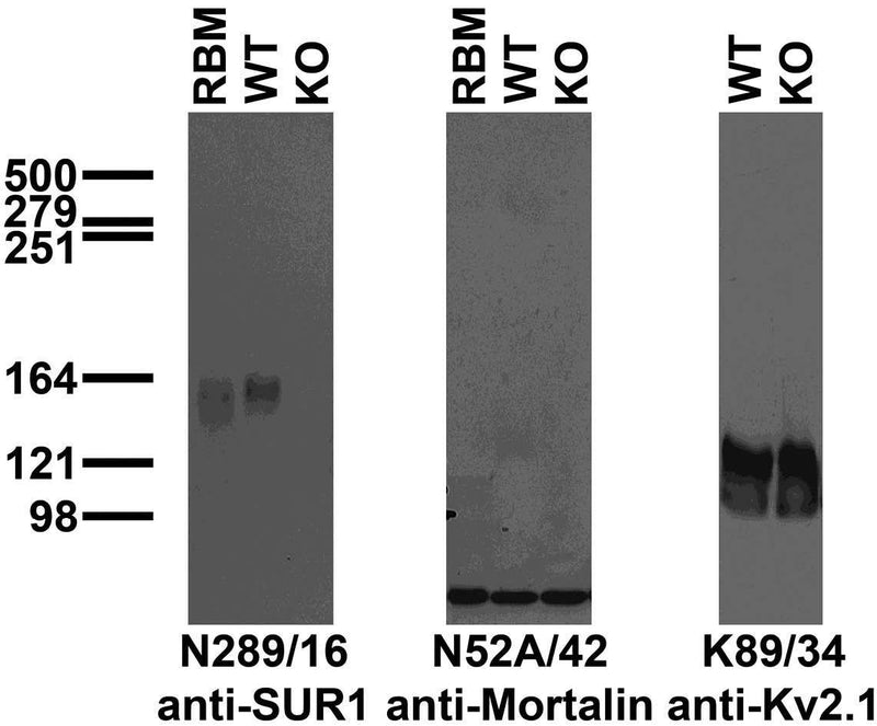 Immunoblot versus crude brain membrane preparations from rat (RBM), SUR1 wild-type (WT) and knockout (KO) mice and probed with N289/16 (left), N52A/42 (center) and K89/34 (right) TC supe. Mouse brains courtesy of William Coetzee and Margaret Rice, New York University Medical Center.