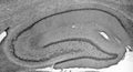 Adult rat hippocampus immunohistochemistry.
